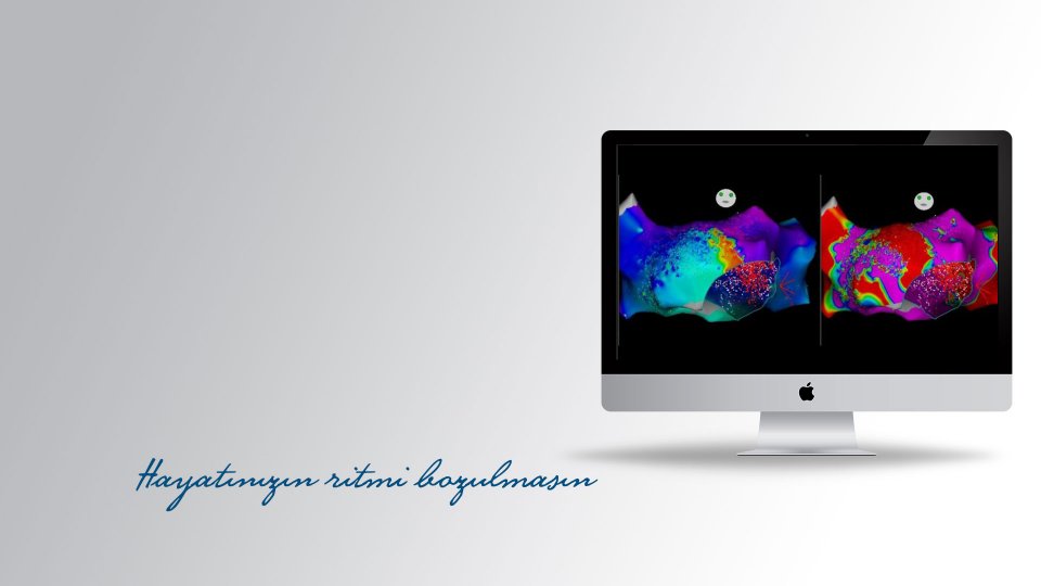 ÜÇ BOYUTLU HARİTALAMA VE KATATER ABLASYON İŞLEMİ İLE HASTAMIZIN YILLAR SÜREN ÇARPINTI ŞİKAYETİ SON BULDU!